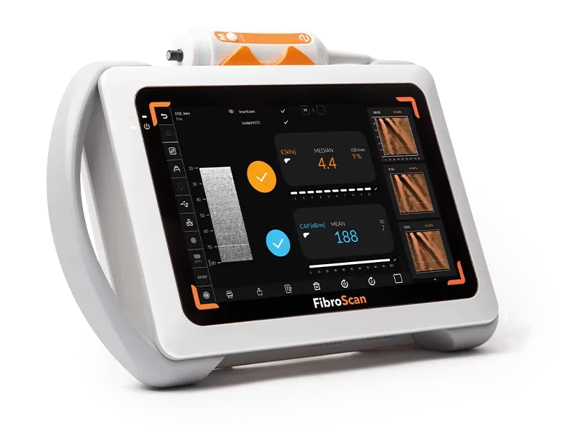Echosens FibroScan Mini+ 430 liver assessment device